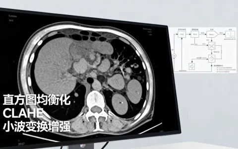 医学图像增强算法有哪些？医学图像增强算法原理