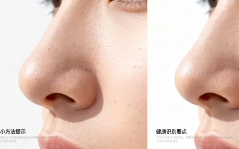 鼻头识别健康视频怎么看？鼻头大怎么变小